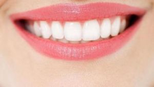 美容冠牙齿矫正(牙齿美容技术)